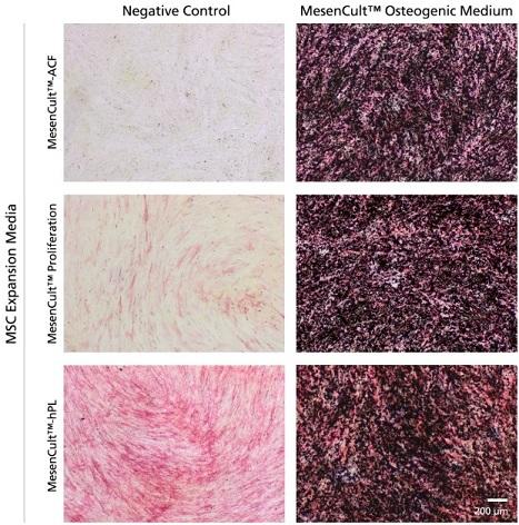 MesenCult Osteogenic Differentiation Kit | 製品情報 | ベリタス